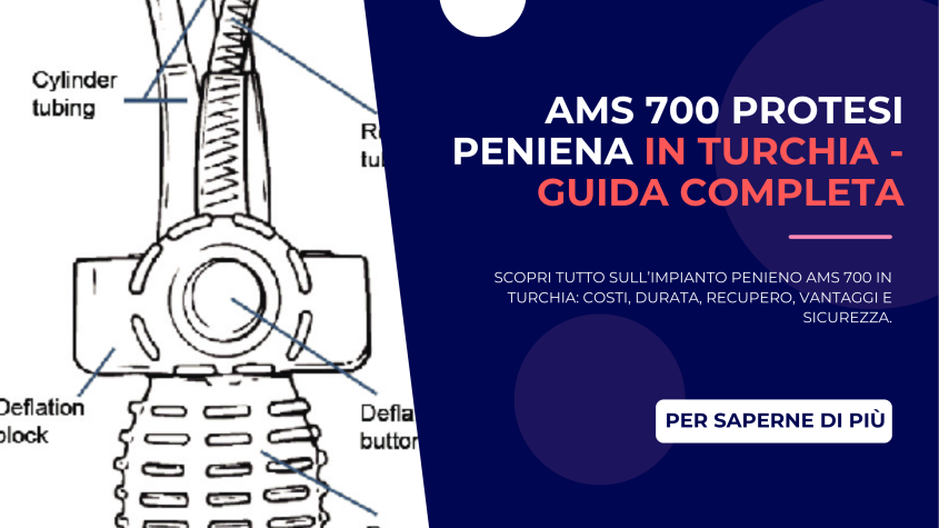 ams 700 Protesi Peniena in Turchia